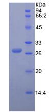 血管生成素1(ANGPT1)重组蛋白,Recombinant Angiopoietin 1 (ANGPT1)