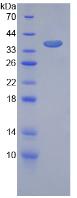 血管内皮生长因子受体1(VEGFR1)重组蛋白,Recombinant Vascular Endothelial Growth Factor Receptor 1 (VEGFR1)