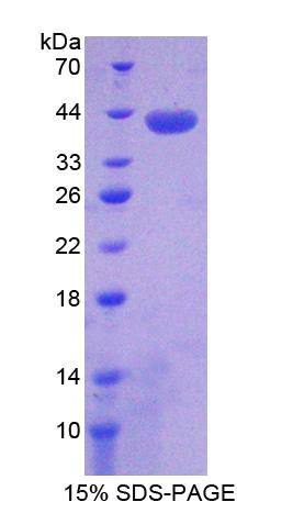 序列相似家族135成員B(FAM135B)重組蛋白,Recombinant Family With Sequence Similarity 135, Member B (FAM135B)