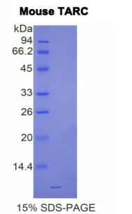 胸腺激活调节趋化因子(TARC)重组蛋白,Recombinant Thymus Activation Regulated Chemokine (TARC)