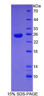 性激素结合球蛋白(SHBG)重组蛋白,Recombinant Sex Hormone Binding Globulin (SHBG)