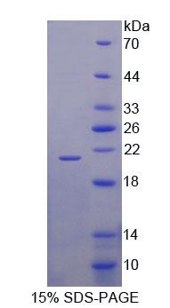 興奮性氨基酸轉(zhuǎn)運(yùn)蛋白4(EAAT4)重組蛋白,Recombinant Excitatory Amino Acid Transporter 4 (EAAT4)