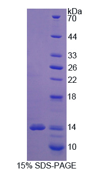 兴奋性氨基酸转运蛋白3(EAAT3)重组蛋白,Recombinant Excitatory Amino Acid Transporter 3 (EAAT3)