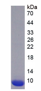 兴奋性氨基酸转运蛋白2(EAAT2)重组蛋白,Recombinant Excitatory Amino Acid Transporter 2 (EAAT2)