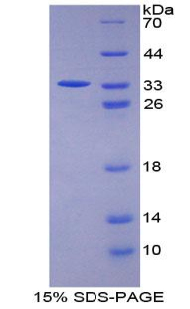 信号转导衔接分子1(STAM1)重组蛋白,Recombinant Signal Transducing Adaptor Molecule 1 (STAM1)