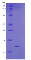 信号素4D(SEMA4D)重组蛋白,Recombinant Semaphorin 4D (SEMA4D)