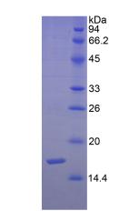 信号素3F(SEMA3F)重组蛋白,Recombinant Semaphorin 3F (SEMA3F)