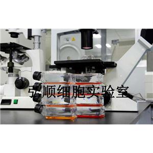 NCI-H1944 Cells|人非小细胞肺癌贴壁细胞,NCI-H1944 Cells