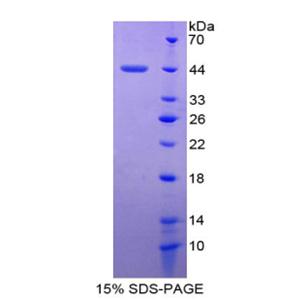 血清淀粉样蛋白A4(SAA4)重组蛋白