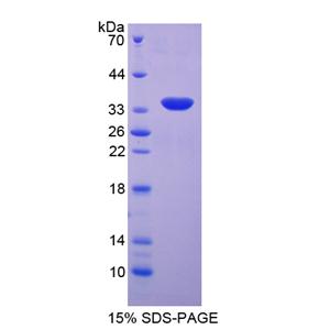 血清/糖皮质激素调节激酶2(SGK2)重组蛋白