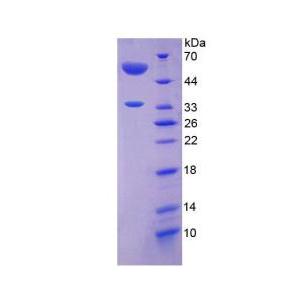 血管生成素样蛋白4(ANGPTL4)重组蛋白