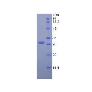 血管生成素1(ANGPT1)重组蛋白