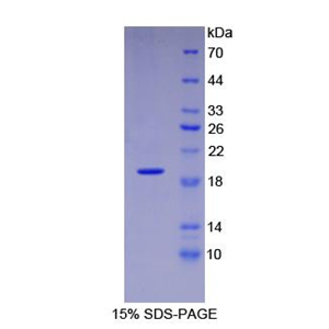 血管内皮生长因子165(VEGF165)重组蛋白