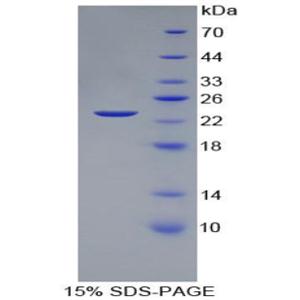 血管内皮生长因子145(VEGF145)重组蛋白