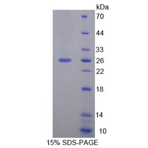 序列相似家族3成员D(FAM3D)重组蛋白