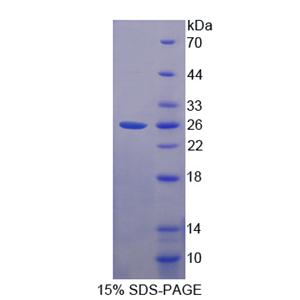 序列相似家族3成员C(FAM3C)重组蛋白,Recombinant Family With Sequence Similarity 3, Member C (FAM3C)