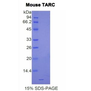 胸腺激活调节趋化因子(TARC)重组蛋白