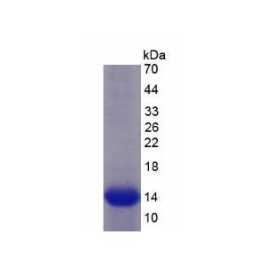 信号素5B(SEMA5B)重组蛋白