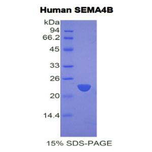 信号素4B(SEMA4B)重组蛋白