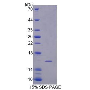 信号素3C(SEMA3C)重组蛋白,Recombinant Semaphorin 3C (SEMA3C)