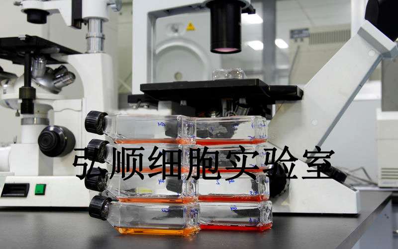 SU-DHL-6 Cells|人淋巴瘤悬浮细胞,SU-DHL-6 Cells