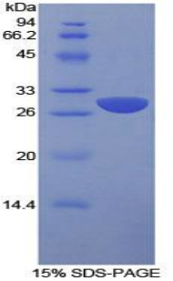 信號(hào)淋巴細(xì)胞激活分子家族成員1(SLAMF1)重組蛋白,Recombinant Signaling Lymphocytic Activation Molecule Family, Member 1 (SLAMF1)