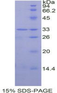 信号传导转录激活因子6(STAT6)重组蛋白,Recombinant Signal Transducer And Activator Of Transcription 6 (STAT6)