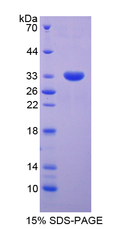 信号传导转录激活因子5B(STAT5B)重组蛋白,Recombinant Signal Transducer And Activator Of Transcription 5B (STAT5B)