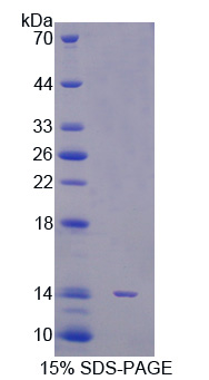 信号传导转录激活因子5A(STAT5A)重组蛋白,Recombinant Signal Transducer And Activator Of Transcription 5A (STAT5A)