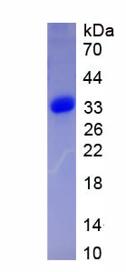 信号传导转录激活因子2(STAT2)重组蛋白,Recombinant Signal Transducer And Activator Of Transcription 2 (STAT2)