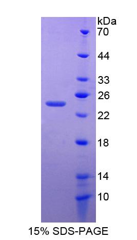 锌指同源框蛋白4(ZFHX4)重组蛋白,Recombinant Zinc Finger Homeobox Protein 4 (ZFHX4)