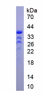 锌指同源框蛋白1B(ZFHX1B)重组蛋白,Recombinant Zinc Finger Homeobox Protein 1B (ZFHX1B)