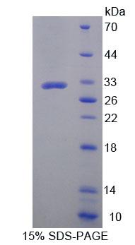 鋅指蛋白10(ZNF10)重組蛋白,Recombinant Zinc Finger Protein 10 (ZNF10)