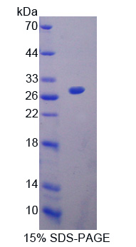 心脏神经嵴衍生物表达蛋白1(HAND1)重组蛋白,Recombinant Heart And Neural Crest Derivatives Expressed Protein 1 (HAND1)