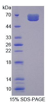 心脏肌球蛋白结合蛋白C(MYBPC3)重组蛋白,Recombinant Myosin Binding Protein C, Cardiac (MYBPC3)