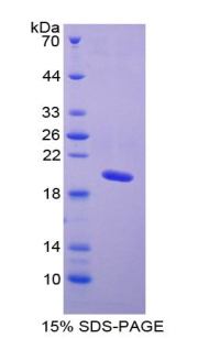 心钠肽(ANP)重组蛋白,Recombinant Atrial Natriuretic Peptide (ANP)