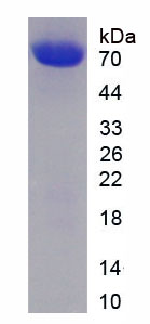 心肌型蘭尼定受體2(RYR2)重組蛋白,Recombinant Ryanodine Receptor 2, Cardiac (RYR2)