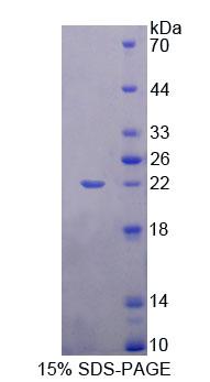 心肌细胞特异性增强因子2A(MEF2A)重组蛋白,Recombinant Myocyte Specific Enhancer Factor 2A (MEF2A)