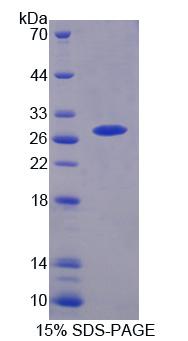 小泛素相关修饰蛋白1(SUMO1)重组蛋白,Recombinant Small Ubiquitin Related Modifier Protein 1 (SUMO1)