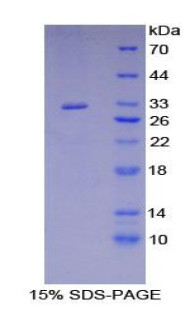 相關(guān)受體酪氨酸激酶(RYK)重組蛋白,Recombinant Related To Receptor Tyrosine Kinase (RYK)