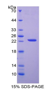 腺嘌呤磷酸核糖转移酶(APRT)重组蛋白,Recombinant Adenine Phosphoribosyltransferase (APRT)