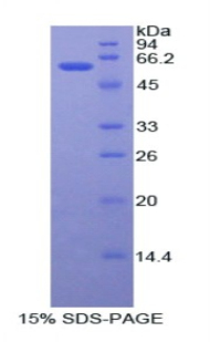 腺苷脫氨酶(ADA)重組蛋白,Recombinant Adenosine Deaminase (ADA)