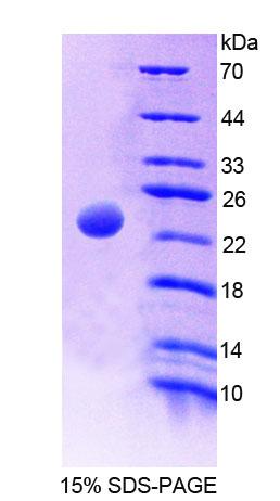 腺苷酸激酶2(AK2)重组蛋白,Recombinant Adenylate Kinase 2 (AK2)