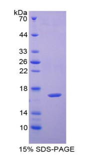 腺苷酸环化酶关联蛋白2(CAP2)重组蛋白,Recombinant Adenylyl Cyclase Associated Protein 2 (CAP2)