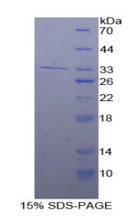 腺苷酸环化酶9(ADCY9)重组蛋白,Recombinant Adenylate Cyclase 9 (ADCY9)