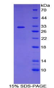 腺苷酸環(huán)化酶7(ADCY7)重組蛋白,Recombinant Adenylate Cyclase 7 (ADCY7)