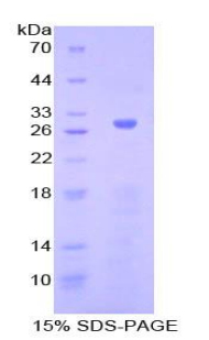 腺苷酸环化酶5(ADCY5)重组蛋白,Recombinant Adenylate Cyclase 5 (ADCY5)