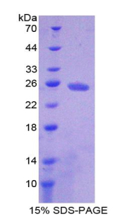 腺苷酸环化酶4(ADCY4)重组蛋白,Recombinant Adenylate Cyclase 4 (ADCY4)