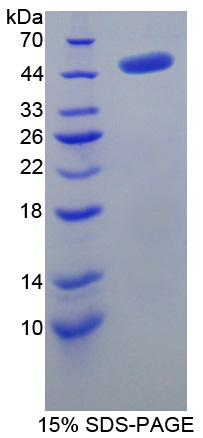 腺苷高半胱氨酸水解酶(AHCY)重组蛋白,Recombinant Adenosylhomocysteinase (AHCY)