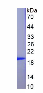 腺苷A2b受體(ADORA2b)重組蛋白,Recombinant Adenosine A2b Receptor (ADORA2b)